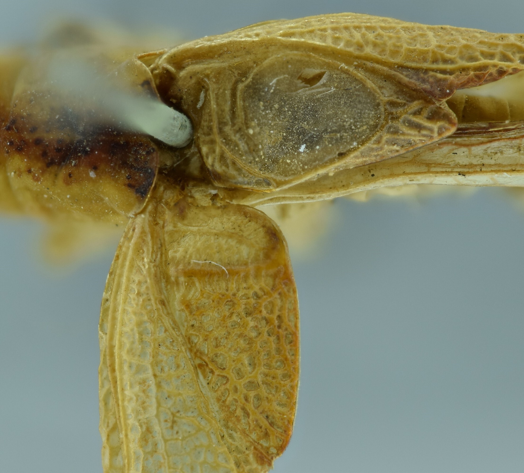 CollectionObject 1532238; 78d770da-3af0-46ad-b0ba-24d0659c686e: male stridulatory area, dorsal view (holotype). (CollectionObject).