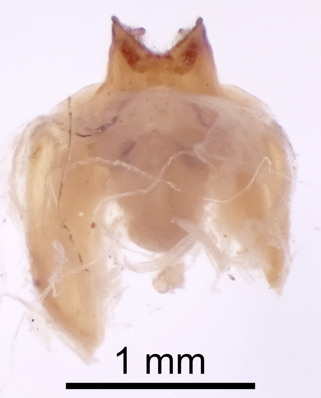 CollectionObject 1522895; b69903f2-95ee-4d7e-bb33-942d68c32d26: Male genitalia, dorsal view (holotype). (CollectionObject).