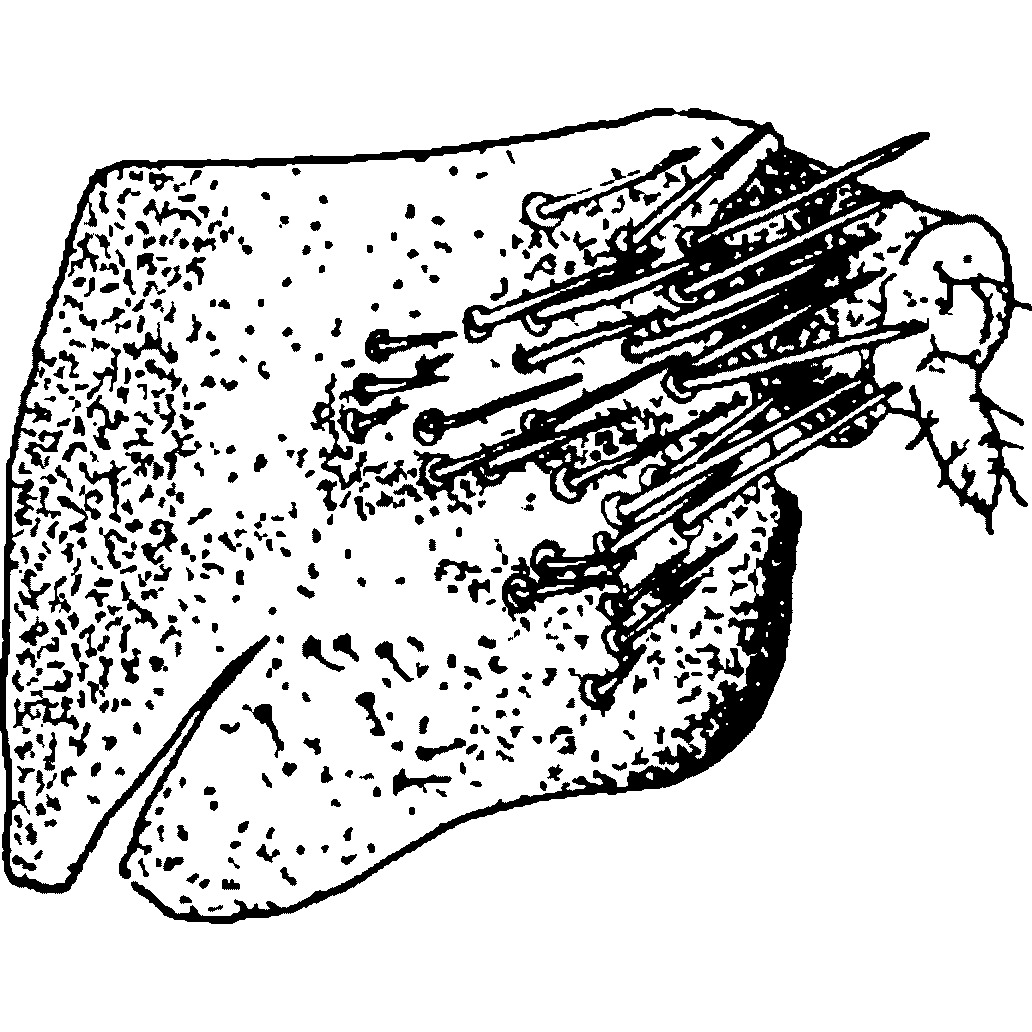 Pygofer, lateral view: !! display not done !! on Mongolojassus alpinus Della Giustina, 1977: Pygofer, lateral view. (Observation).