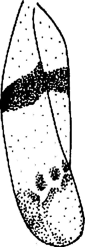 Forewing: Forewing. (Observation).