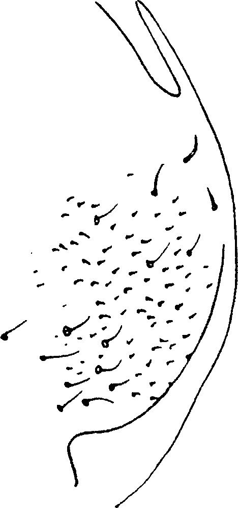 Pygofer, lateral view: Pygofer, lateral view. (Observation).