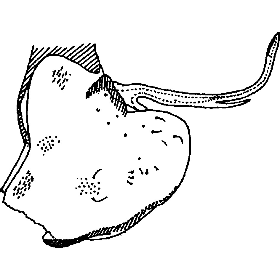 Pygofer, lateral view: Pygofer (M. chimera Dwor.). (Observation).