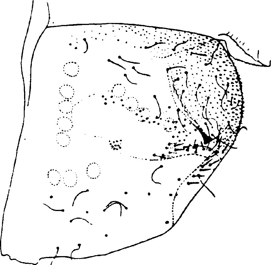 Pygofer, lateral view: Pygofer (E. bisetosa Dwor.). (Observation).