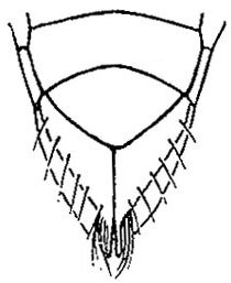 Subgenital plate: !! display not done !! on Macrosteles lepidus (Van Duzee, 1894): genital capsule, ventrally. (Observation).