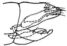 Pygofer, lateral view: !! display not done !! on Laevicephalus unicoloratus (Gillette & Baker, 1895): genital capsule, laterally. (Observation).