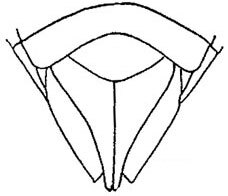 Subgenital plate: !! display not done !! on Polyamia (Copolyamia) brevipennis DeLong & Davidson, 1935: genital capsule, ventrally. (Observation).