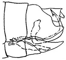 Pygofer, lateral view: genital capsule, laterally. (Observation).