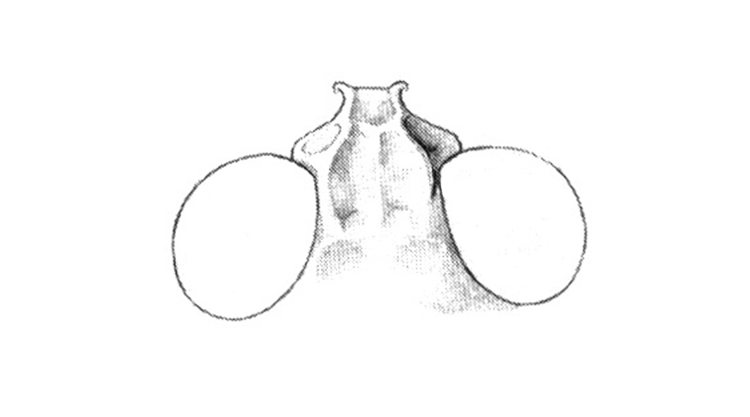 Dissosteira pictipennis Bruner, 1905: Fig. 40G. fastigium. (Otu).