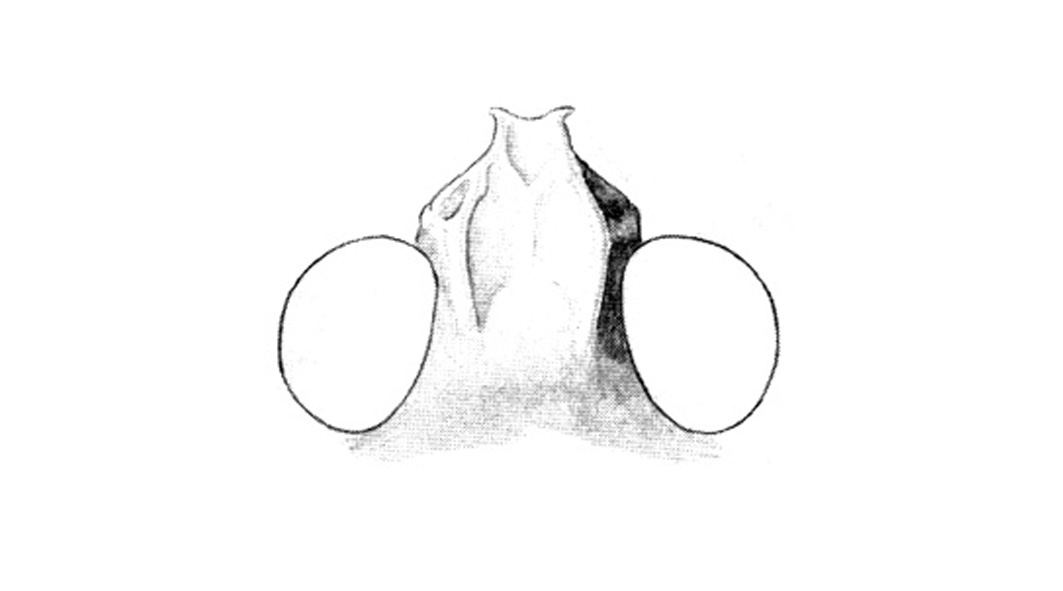 Trimerotropis agrestis McNeill, 1900: Fig. 49E. fastigium. (Otu).