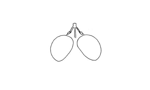 Stenopola puncticeps tenae Roberts & Carbonell, 1979: Fig. 10A. male, eyes and fastigium, dorsal view. (Otu).