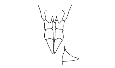 Poecilocloeus flavipictus Bruner, 1913: Fig. 256. female subgenital plate, ventral view, and cercus. (Otu).