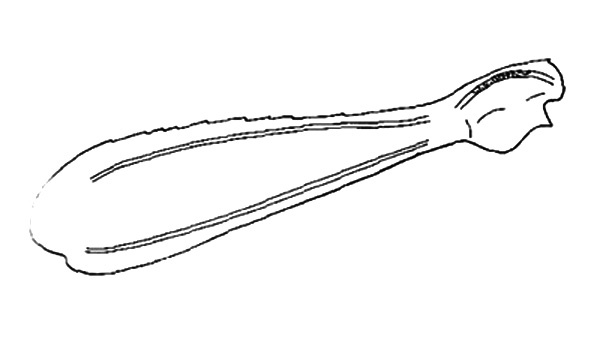 Taeniophora tenuipes Descamps & Amédégnato, 1971: Fig. 34. hind femur, lateral view. (Otu).