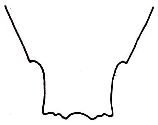 Mastachopardia mirei Descamps, 1973: Fig. 34. rear end of female subgenital plate, ventral view. (Otu).