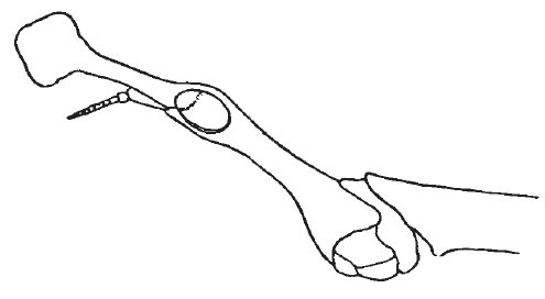 Bolidorhynchus insignis (Hebard, 1931): Pl. 1, Fig. 2 (after type). lateral outline of female head. (Otu).