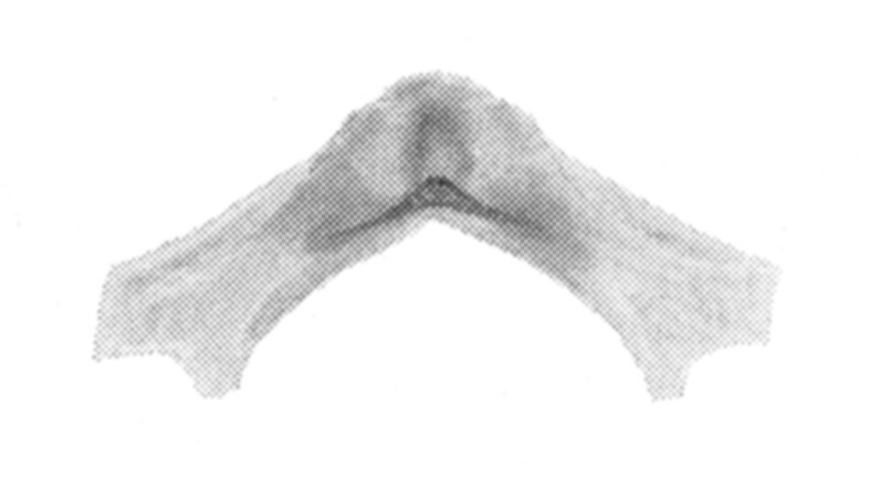 Ceuthophilus (Ceuthophilus) rehni Hubbell, 1936: Fig. 53. Epiphallus. (Otu).