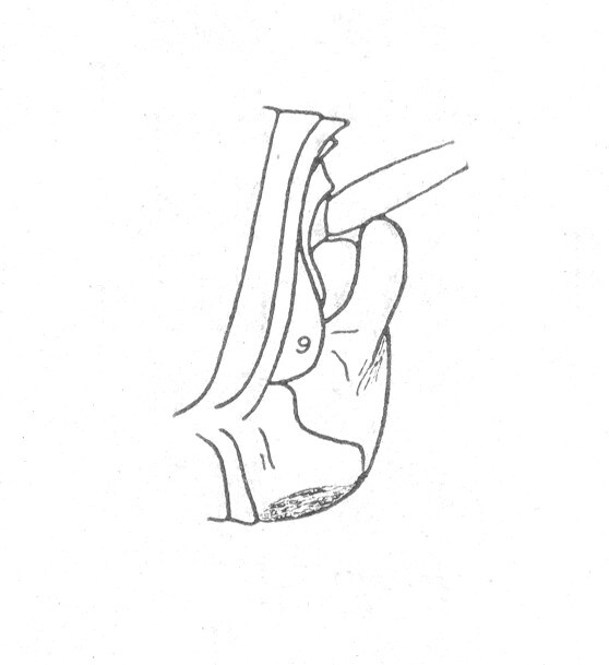 Ceuthophilus (Hemiudeopsylla) hesperus transitans Hubbell, 1936: Fig. 572. male abdomen tip. (Otu).
