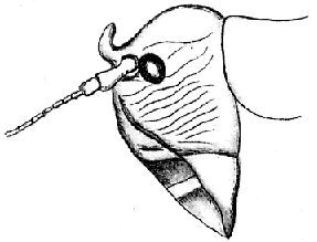 Salomona uncinata Carl, 1908: male head lateral. (Otu).