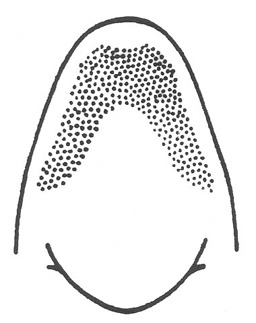 Neoconocephalus ensiger (Harris, 1841): shape and coloration of cone, ventral view. (Otu).