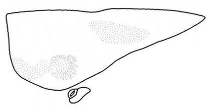 Pseudokuzicus (Similkuzicus) quadridentatus Shi, Mao & Chang, 2007: Fig. 13 (reproduced by permission). pronotum, lateral view (lenght 3.8 mm in male). (Otu).