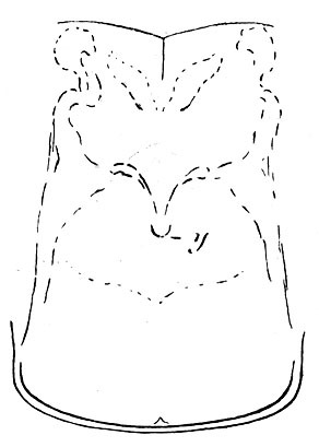 Topana (Topana) cincticornis (Stål, 1873): Fig. 70 A (after type). male pronotum, dorsal view. (Otu).