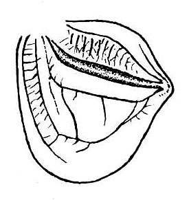 Cohnia inca (Rehn, 1955): Fig. 3. stridulating field of left tegmen. (Otu).