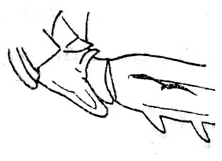 Rhinischia vicina Beier, 1954: Fig. 201. mid coxa. (Otu).