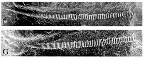 Phricta aberrans (Brunner von Wattenwyl, 1895): Fig. 4 F (neotype) G (Mt. Nebo). scanning electron micrographs of stridulatory file. (Otu).