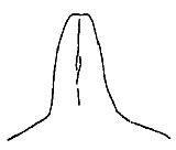 Callimenellus albolineatus Gorochov & Voltshenkova, 2005: Fig. 13. male fastigium, dorsal view. (Otu).