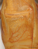 CollectionObject 1588361; 7246837a-206e-488c-a49a-d787314fc7db: male, stridulatory area, scale bar 5 mm. (CollectionObject).
