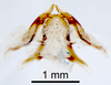 CollectionObject 1507480; a7baa946-634e-448d-8d86-36036ab641ae: Male genitalia, dorsal view (holotype). (CollectionObject).