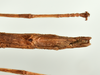 CollectionObject 1586090; QIMR QM T244739-T244740, 175ff28a-d506-43cf-aad5-07437cba24d4: copyright QM, Brisbane. female: end of abdomen, ventral view (paratype). (CollectionObject).