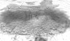 Connective.: Hairs on subgenital plate of A. fabae. (Observation).
