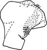 Pygofer, lateral view on Edwardsiana prunicola (Edwards, 1914): Pygofer, lateral view. (Observation).