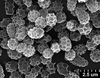 Brochosomes: CR775 | U.S.A., Montana, Jefferson Co., Homestake, R. Rakitov [#04-49], 19-V-2004 | INHS. (Observation).