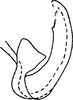 Aedeagus, lateral view on Exitianus nanus (Distant, 1908): Aedeagus, lateral view. (Observation).