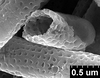 Brochosomes: AG63 | Costa Rica, Turrialba | [no date] | Schild & Burgdorf | USNM. (Observation).