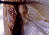 Anaulacomera (Anaulacomera) crassidentata Hebard, 1927: male stridulatory apparatus (paratype). (Otu).