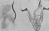 Other: Pygofer lobe, aedeagus, connective, and styli. (Observation).