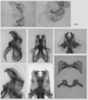 Melanoplus glaucipes (Scudder, 1875): male genitalia. (Otu).