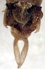 CollectionObject 1516929; 501178ef-a6ca-4b8f-aec4-c9c9a505ba70: male abdomen tip, dorsal view (holotype). (CollectionObject).