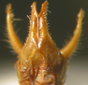 CollectionObject 1476144; 7f1c841b-e43b-4a4a-8528-5065deb643d9: male abdominal apex, ventral view (holotype). (CollectionObject).