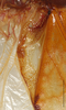CollectionObject 1586787; b9a802c2-d6ad-43c6-8d36-4a4332c9774e: right stridulatory area, scale bar 5 mm. (CollectionObject).