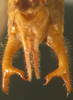 CollectionObject 1475679; ef147de6-945b-48e7-8582-95547db27a17: male abdominal apex, ventral view (holotype). (CollectionObject).