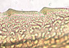 Ovipositor: Icaia laoroya, 2nd valvula teeth (INHS). (Observation).