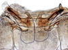 Abdomen, sternal apodemes, ventral view: !! display not done !! on Dorycephalus Kouchakéwitch, 1866: Dorycephalus baeri, abdominal sternal apodemes (INHS). (Observation).