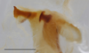 CollectionObject 1585131; e96d3a2f-b304-4cc9-913d-61c3c7299449: male, phallus (scale bar: 1 mm). (CollectionObject).
