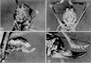 Cojedebius kathleenae Kevan, 1989: male, female A, male holotype, frontal view of head; B. the same, male allotype; holotype, lateral view of abdominal terminalia; D, the same, female allotype. (Otu).