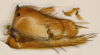 Pygofer, lateral view: (Observation).