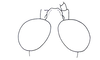Ananotacris abditicolor Descamps, 1978: Fig. 77. Male, head (dorsal view). (Otu).