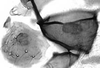 Stylus.: !! display not done !! on alate viviparous female: Aphis (Aphis) rumicis Linnaeus, 1758: First marginal tubercle and coxa of A. rumicis. (Observation).